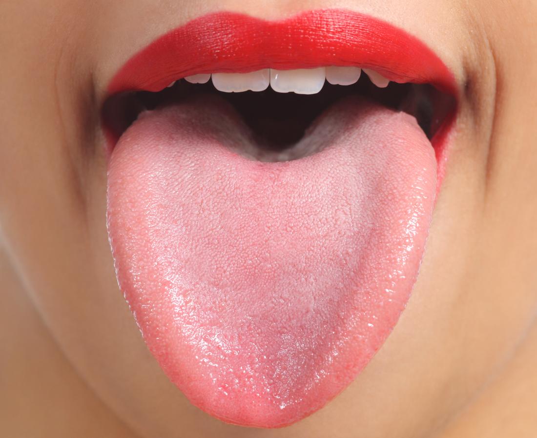 World SecretsWorld Secrets   Close Up Of Spots On Tongue 